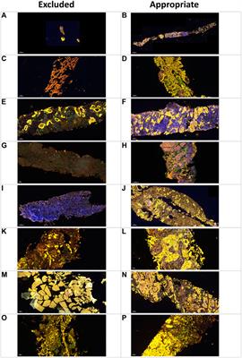 Pathology Quality Control for Multiplex Immunofluorescence and Image Analysis Assessment in Longitudinal Studies